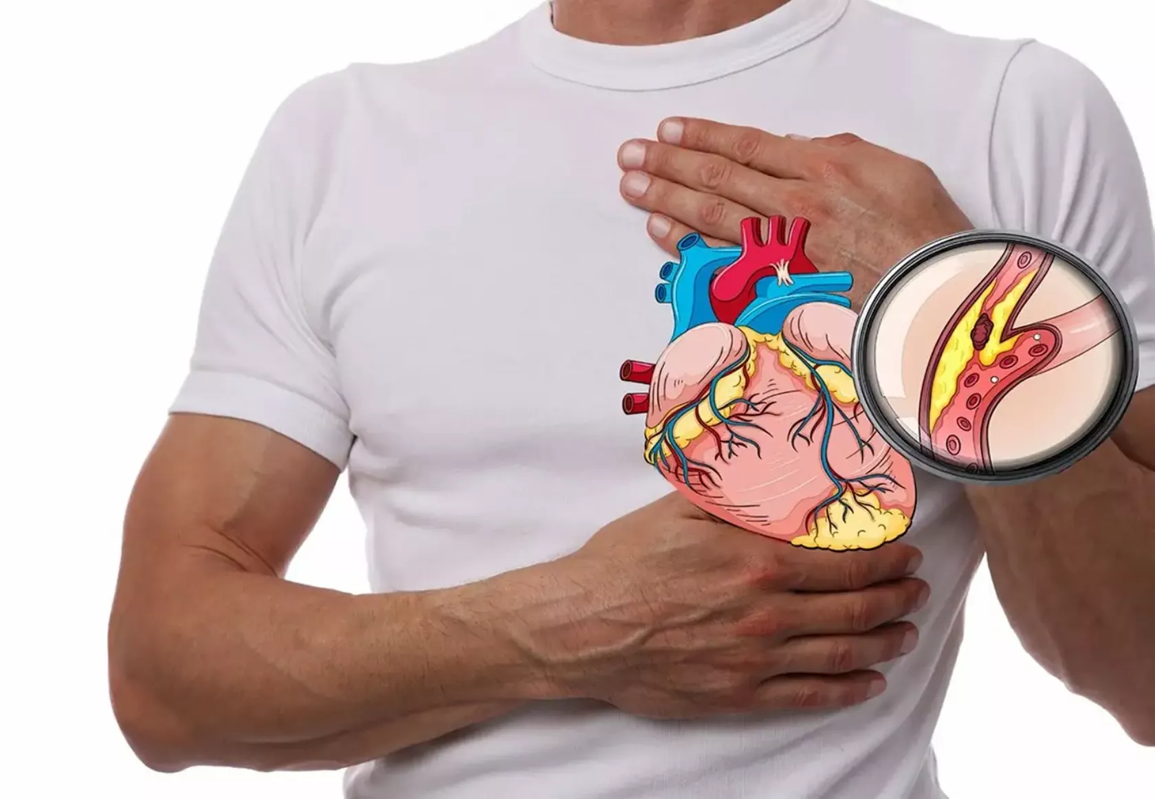 Herzgefäße vor männlicher Brust in Detaildarstellung