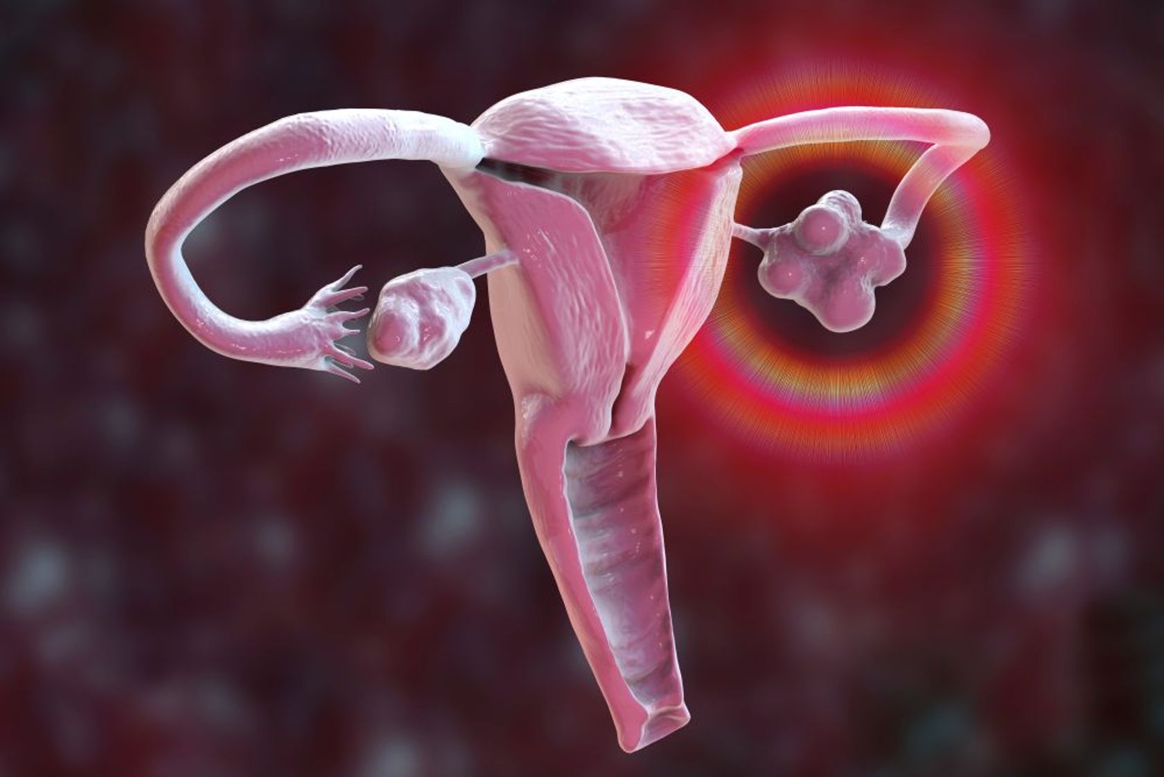 AI-Darstellung des weiblichen Reproduktionssystems mit einem polyzystischem Ovar.