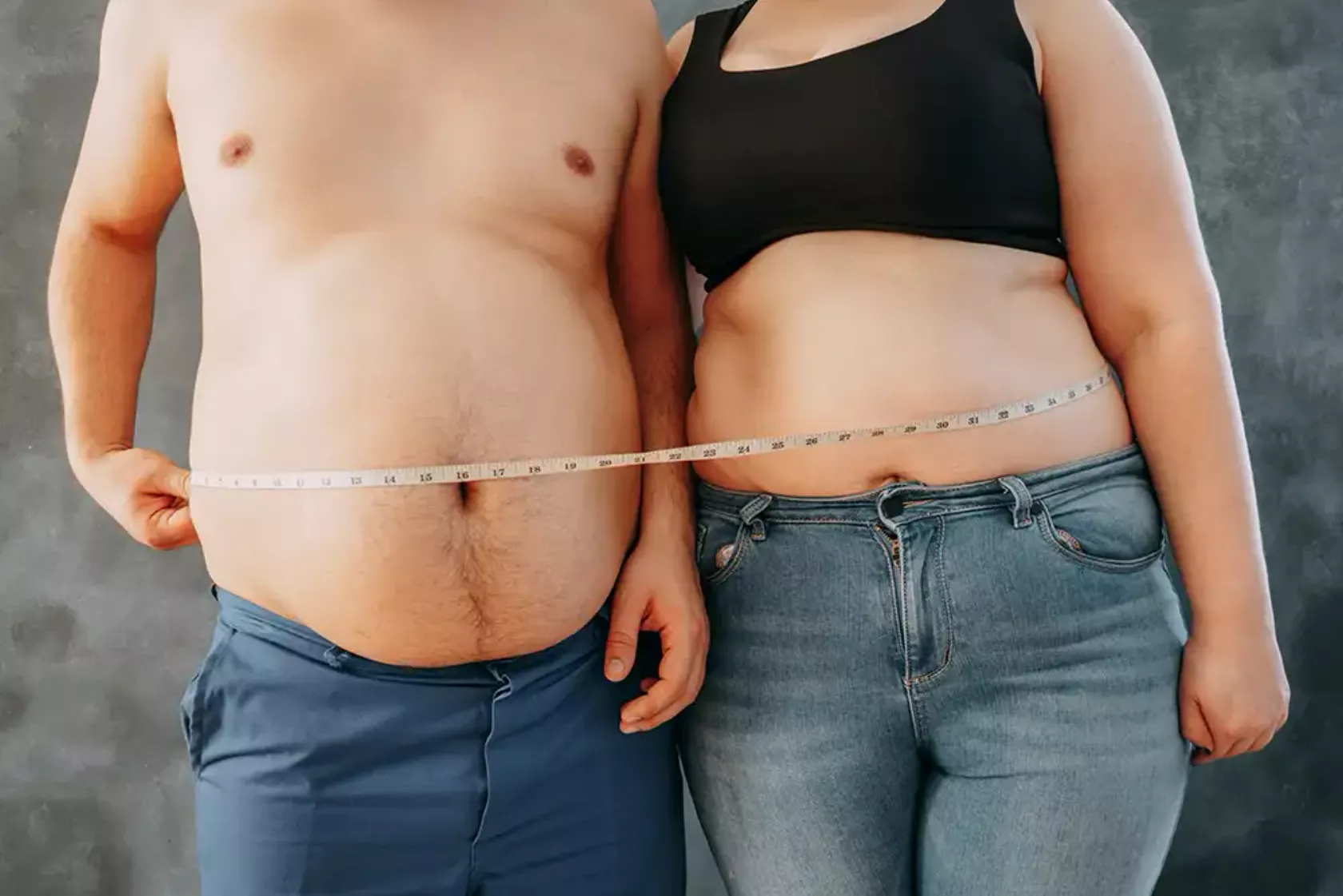 Stark übergewichtiges Paar zeigt seine nackten Bäuche.